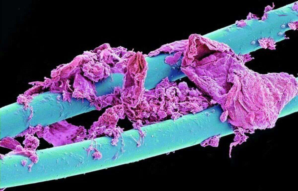 تصویر میکروسکوپی نخ دندان پس از استفاده